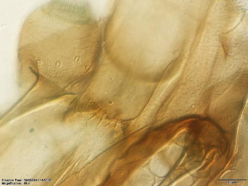 Lutzomyia walkeri species group Migonei Newstead, 1914 - Lutzomyia_walkeri-BMNH(E)1722102_PR-female_cibarium-40x.tif