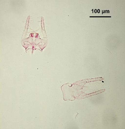 Trichomyia inopis Duckhouse, 1978 - Trichomyia_inopis-010210271-genitalia-250_0x-scale-scale