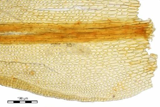 Tridontium tasmanicum Hook.f. - Gymnostomum brotherusii_BM001006469leafbase.j