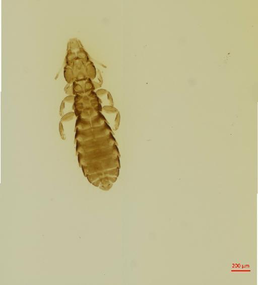 Quadraceps guimaraesi Timmermann, 1954 - 010687252__2017_08_10-Scene-2-ScanRegion1