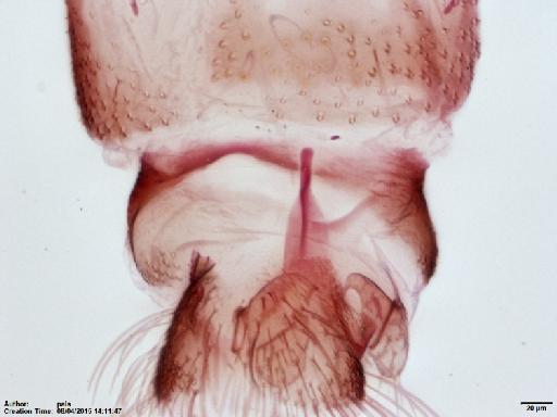 Lutzomyia (Helcocyrtomyia) hartmanni Fairchild & Hertig, 1957 - Lutzomyia_hartmanni-BMNH(E)1722008_PT-female_T8-20x.tif