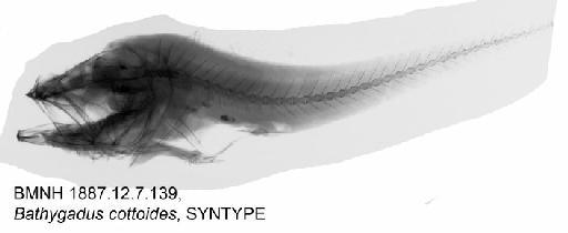 Bathygadus cottoides Günther, 1878 - BMNH 1887.12.7.139, Bathygadus cottoides, SYNTYPE, Radiograph