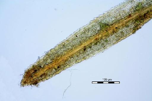 Syrrhopodon confertus Sande Lac. - Syrrhopodon ameonus_BM000672704spine12.jpg