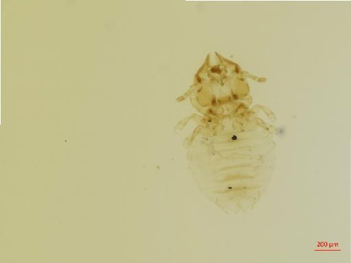 Felicola (Suricatoecus) bedfordi Hopkins, 1942 - 010696946__2017_08_16-Scene-1-ScanRegion0