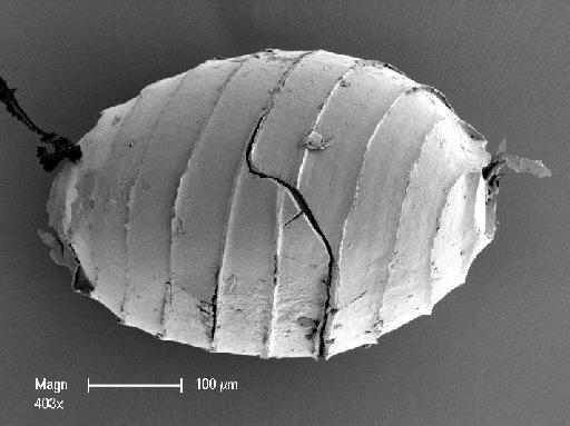 Chara fibrosa var. drummondii (A.Braun) C.Agardh - OosporeSide