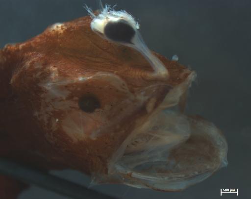 Oneirodes myrionemus Pietsch, 1974 - BMNH_1998.8.9.22_Oneiroides_myrionemus_lure_1