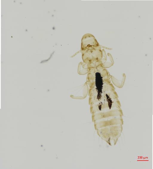 Oxylipeurus importunuus Carriker, 1945 - 010682439__2017_08_09-Scene-1-ScanRegion0