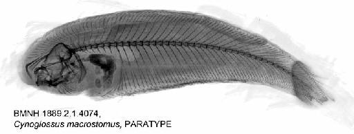 Cynoglossus deltae Jenkins, 1910 - BMNH 1928.3.20.133, Cynoglossus deltae, PARALECTOTYPE, Radiograph