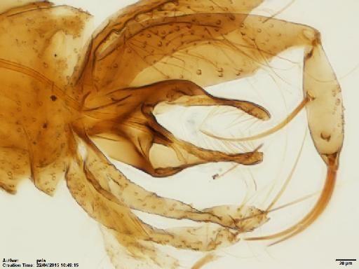 Lutzomyia (Nyssomyia) shawi Fraiha et al., 1981 - Lutzomyia_shawi_BMNH(E)1722061_PT-male_terminalia-20x.tif