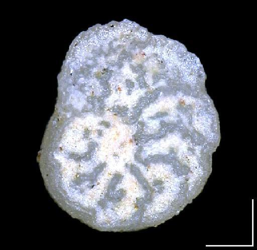 Truncatulina excolata Cushman, 1926 - P47558_Stensioeina excolata1_spiral.jpg