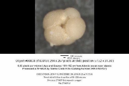 Neogloboquadrina dutertrei (d'Orbigny) - ZF6437-Globoquadrina-eggeri_obj00008_plane000.jpg