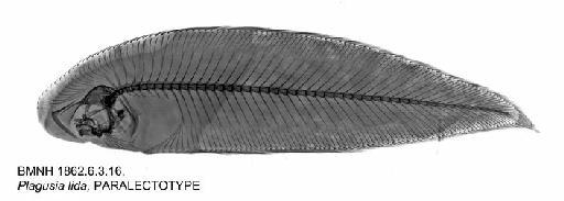 Plagusia lida Bleeker, 1851 - BMNH 1862.6.3.16, Plagusia lida, PARALECTOTYPE, Radiograph