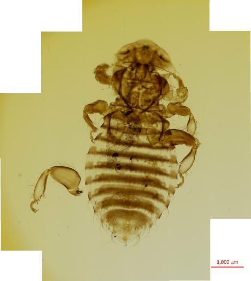 Ancistrona procellariae Westwood, 1874 - 010651475__2017_07_18-Scene-1-ScanRegion0