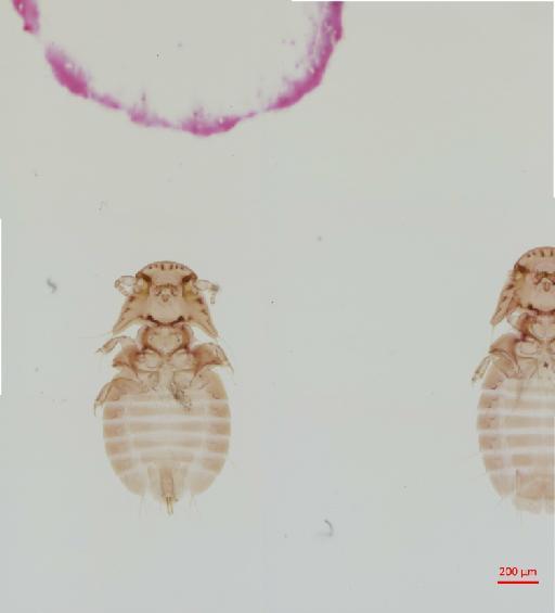 Heptapsogaster dilatatus Rudow, 1870 - 010677649__2017_08_08-2-Scene-1-ScanRegion0