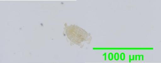 Liposcelis albothoracicus Broadhead, 1955 - 010150247__2016_03_15-4_s05