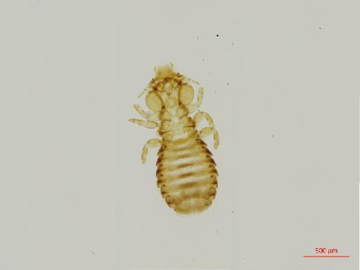 Trabeculus fuscoclypeatus Johnston & Harrison, 1912 - 010694918__2017_08_15-Scene-1-ScanRegion0