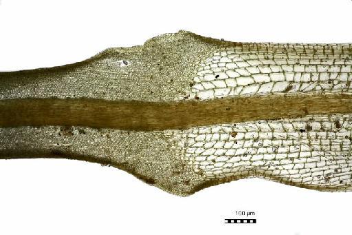 Calymperes palisotii Schwägr. - BM000556220-Calymperes_incertum-apex_hyaline_lamina_dorsal