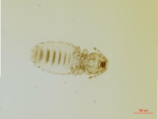 Bovicola (Spinibovicola) hemitragi Cummings, 1916 - 010695723__2017_08_15-Scene-1-ScanRegion0