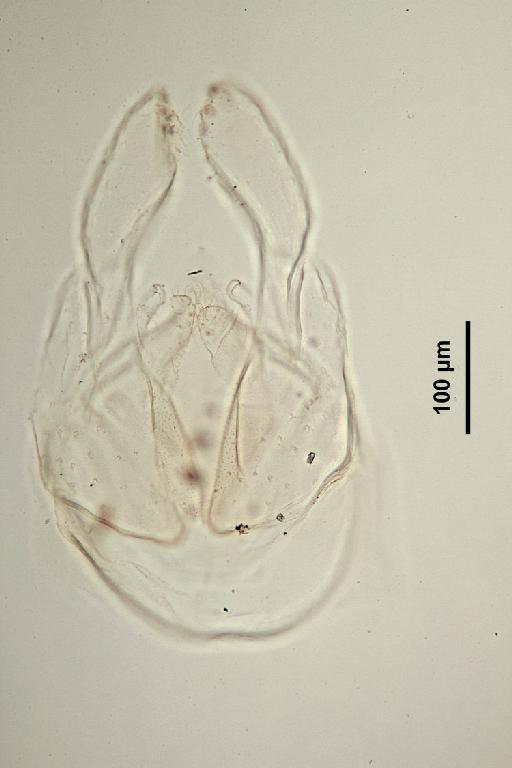 Chironomus platycnemis Edwards - 010210359-Chironomus_platycnemis-genitalia2-320_0x-scale