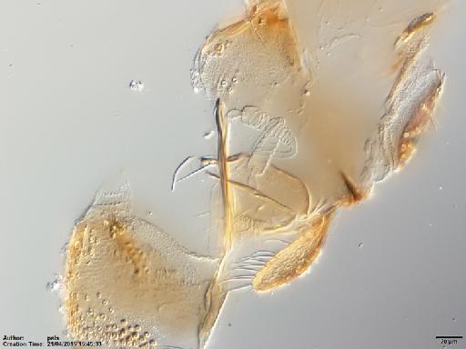 Lutzomyia (Nyssomyia) olmeca olmeca (Vargas & Diaz Najera, 1959) - Lutzomyia_olmeca_nociva-BMNH(E)1722066_PT-female_spermathecae-20x.tif