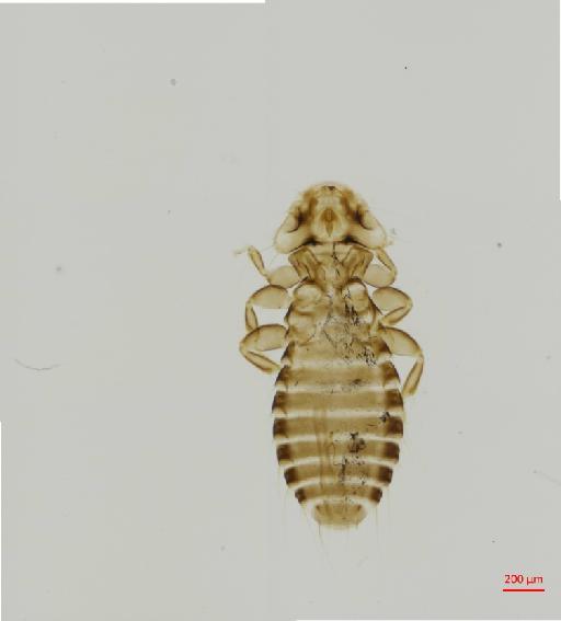 Pseudomenopon mendesi porphyrii Tendeiro, 1965 - 010663477__2017_07_26-Scene-2-ScanRegion1