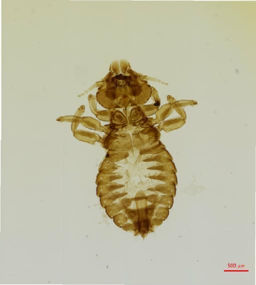 Ibidoecus dianae Tandan, 1958 - 010677953__2017_08_08-2-Scene-1-ScanRegion0