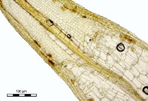 Syrrhopodon revolutus Dozy & Molk. - Syrrhopodon revolutus_BM000672861hyalines