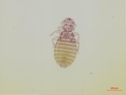 Austromenopon lutescens Burmeister, 1838 - 010651912__2017_07_19-Scene-1-ScanRegion0