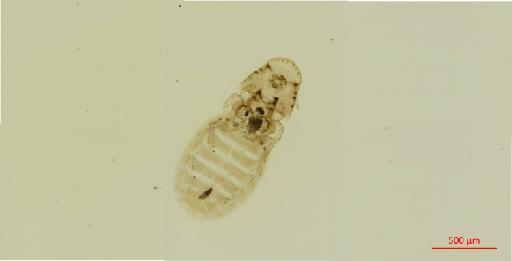 Heptapsogaster subdilatata Piaget, 1880 - 010677749__2017_08_08-2-Scene-1-ScanRegion0