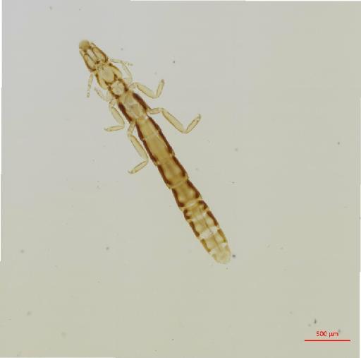 Halipeurus subclavus Timmermann, 1961 - 010680403__2017_08_07-Scene-2-ScanRegion1