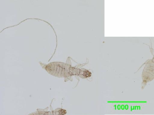 Liposcelis paetus Pearman, 1942 - 010150900__2016_03_17_s14