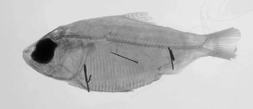 Alosa pectinata Jenyns, 1842 - BMNH 1843.2.8.47, SYNTYPE, Alosa pectinata, radiograph