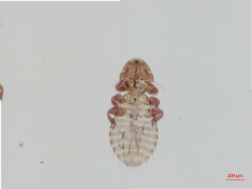 Austromenopon merguli Timmermann, 1954 - 010651925__2017_07_19-Scene-2-ScanRegion1