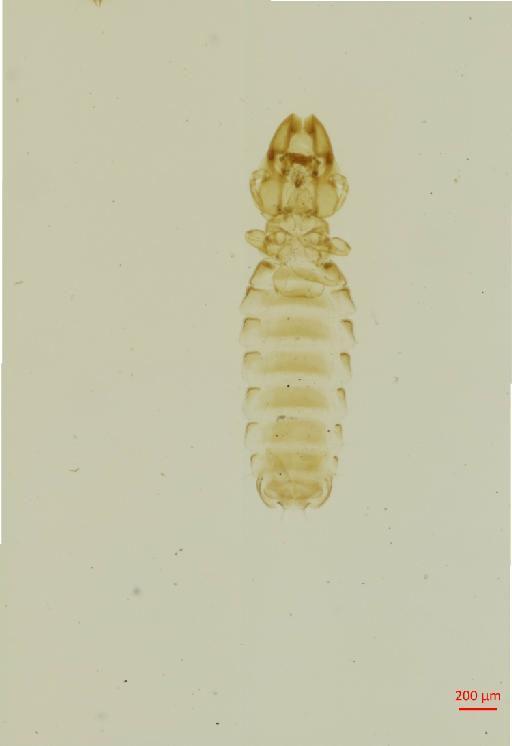 Tricholipeurus cornuta Gervais, 1844 - 010697998__2017_08_17-Scene-2-ScanRegion1