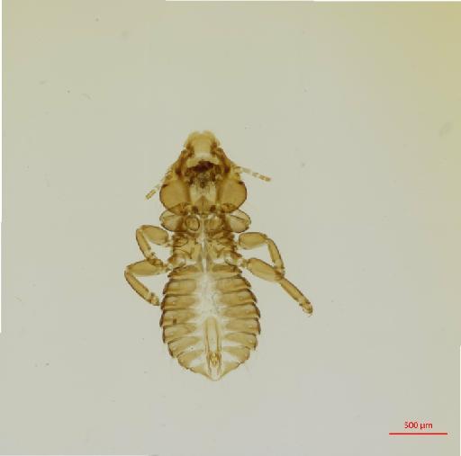 Neophilopterus phillipsi Hajela, 1970 - 010678675__2017_08_08-Scene-1-ScanRegion0