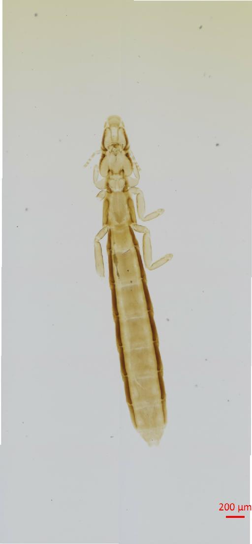 Halipeurus noctivagus Timmermann, 1960 - 010680287__2017_08_07-Scene-1-ScanRegion0