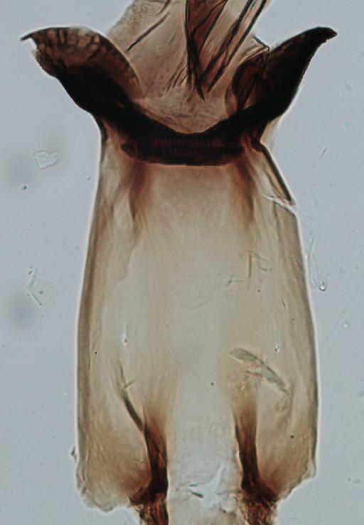 Simulium (Trichodagmia) perplexum species group Orbitale Shelley et al., 1989 - 010195831_S_perplexum_Female_Paratype_cibarium