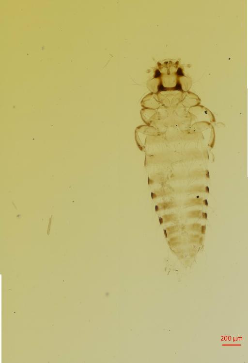 Colpocephalum clayella Brinck, 1955 - 010653649__2017_07_19-Scene-1-ScanRegion0