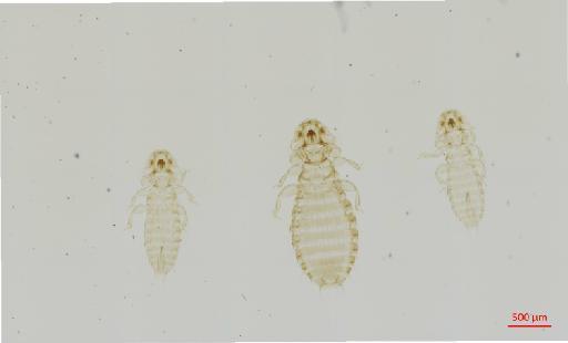 Pseudomenopon pacificum Kellogg, 1896 - 010663481__2017_07_26-Scene-1-ScanRegion0