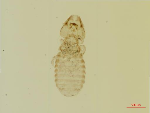 Rallicola (Aptericola) gadowi Harrison, 1915 - 010689959__2017_08_10-Scene-1-ScanRegion0