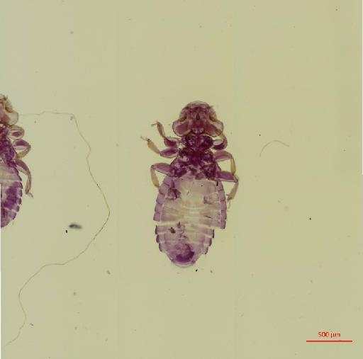 Myrsidea elegans Ansari, 1956 - 010661873__2017_07_24-Scene-2-ScanRegion1