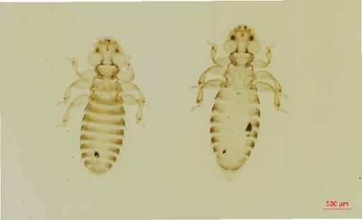 Franciscoloa erythropteri Price, 1967 - 010656716__2017_07_21-Scene-1-ScanRegion0