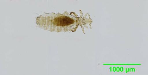 Polyplax otomydis Cummings, 1912 - 010155930__2015_12_22