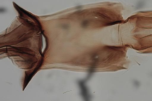 Simulium (Trichodagmia) scutistriatum species group Orbitale Lutz, 1909 - 010195917_Simulium_Trichodagmia_scutristriatum_cibarium