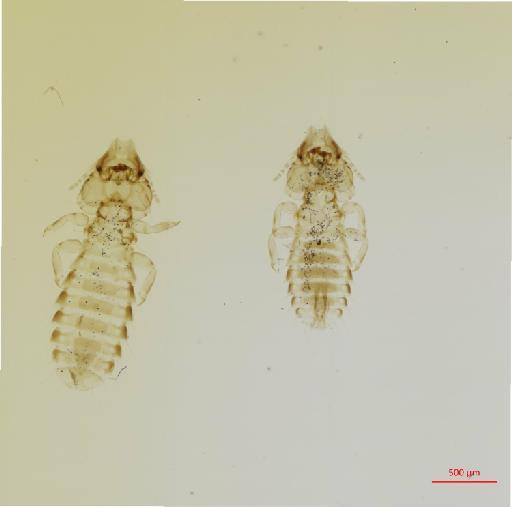 Rallicola (Furnaricola) certhia Carriker, 1963 - 010690282__2017_08_11-Scene-1-ScanRegion0