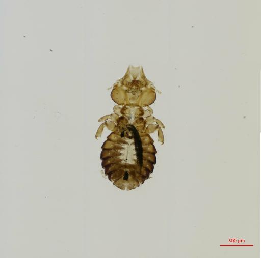 Saemundssonia desolata Timmermann, 1959 - 010691072__2017_08_11-Scene-1-ScanRegion0