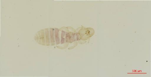 Lunaceps paschalis Timmermann, 1954 - 010681924__2017_08_08-Scene-1-ScanRegion0