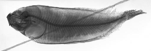 Monolene antillarum Norman, 1933 - BMNH 1930.9.4.15, PARATYPE, Monolene antillarum, radiograph