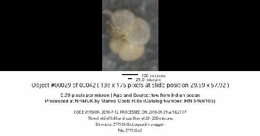 Neogloboquadrina dutertrei (d'Orbigny) - ZF7105-Globoquadrina-eggeri_obj00029_plane000.jpg