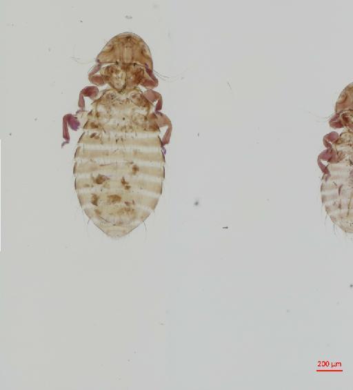 Austromenopon merguli Timmermann, 1954 - 010651925__2017_07_19-Scene-1-ScanRegion0